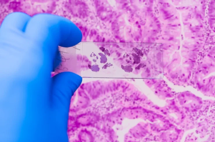Histopathology